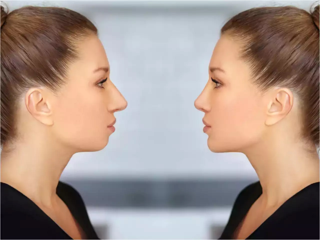 Jaw Line Creation